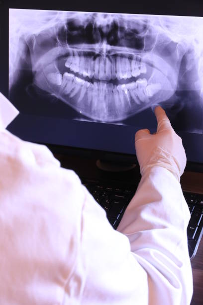 Best Emergency Treatment for Dental Infections or Abscesses in Sawmills, NC