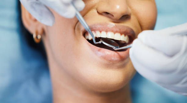 Best Emergency Dental Care for Broken or Chipped Teeth in Sawmills, NC