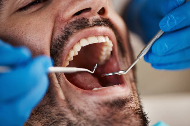 Best Emergency Treatment for Dental Infections or Abscesses in Sawmills, NC