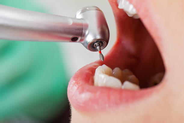 Best Weekend Emergency Dentist in Sawmills, NC